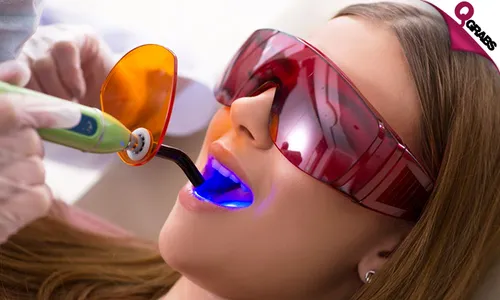 Dental Services: Extraction, Filling, Jewel & Hollywood Smile!